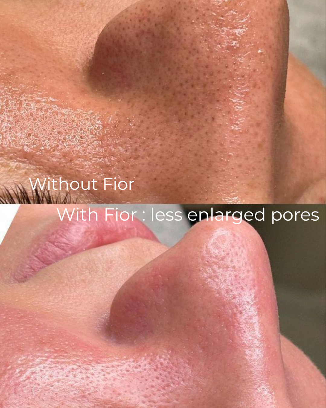 Fior Barrier Repair Milk